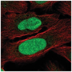ZNF776 Antibody, Novus Biologicals 100&mu;L; Unlabeled:Antibodies, Polyclonal