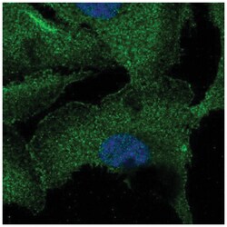 ZNF785 Antibody, Novus Biologicals 100&mu;L; Unlabeled:Antibodies, Polyclonal