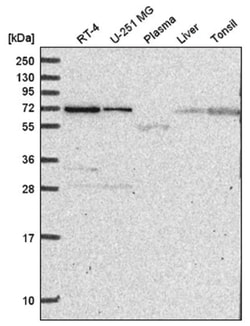 ZNF786 Antibody, Novus Biologicals 100 &mu;L | Buy Online | Novus Biologicals | Fisher Scientific