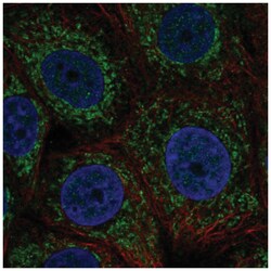 ZNHIT3 Antibody, Novus Biologicals 100&mu;L; Unlabeled:Antibodies, Polyclonal