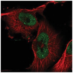 ZXDB Antibody, Novus Biologicals:Antibodies:Primary Antibodies