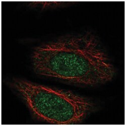 ZYG11A Antibody, Novus Biologicals 100&mu;L; Unlabeled:Antibodies, Polyclonal