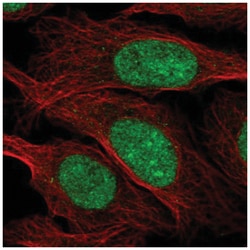 ZZZ3 Antibody, Novus Biologicals 100&mu;L; Unlabeled:Antibodies, Polyclonal