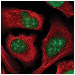 ZZZ3 Antibody, Novus Biologicals:Antibodies:Primary Antibodies