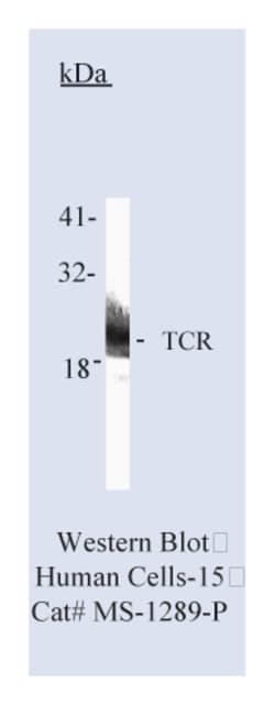 anti-CD3zeta/T Cell Receptor zeta Ab-8, Clone: 6B10, Epredia LabVision:Antibodies:Primary