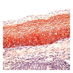 Epredia Lab Vision Cadherin-P Ab-1, Mouse Monoclonal Antibody:Antibodies:Primary