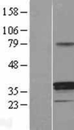 Novus Biologicals&trade;&nbsp;11 beta-HSD1 Overexpression Lysate