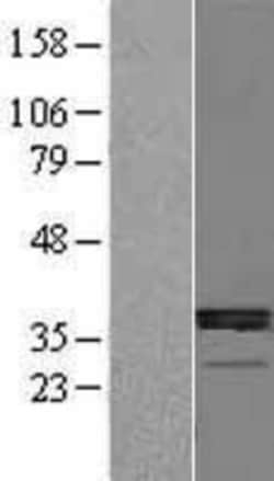 Novus Biologicals&trade;&nbsp;11 beta-HSD1 Overexpression Lysate