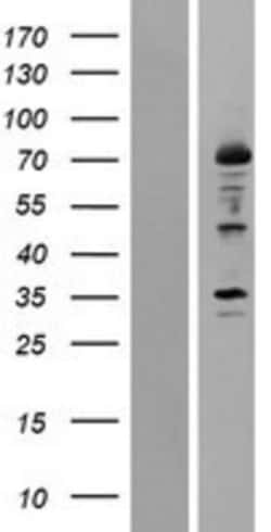 Novus Biologicals&trade;&nbsp;12-Lipoxygenase Overexpression Lysate