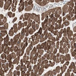 12-Lipoxygenase Antibody, Novus Biologicals 0.1mL; Unlabeled:Antibodies,