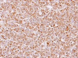 14-3-3 epsilon Antibody, Novus Biologicals 0.1mL; Unlabeled:Antibodies,