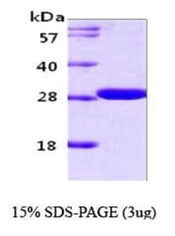 Novus Biologicals&trade;&nbsp;Recombinant Human 14-3-3 gamma Protein