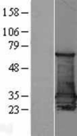 Novus Biologicals&trade;&nbsp;14-3-3 sigma/Stratifin Overexpression Lysate