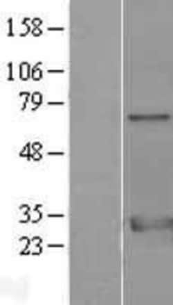 Novus Biologicals™ 14-3-3 zeta/beta Overexpression Lysate