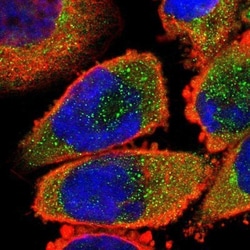 14-3-3 beta/alpha Antibody, Novus Biologicals 0.1mL; Unlabeled:Antibodies,