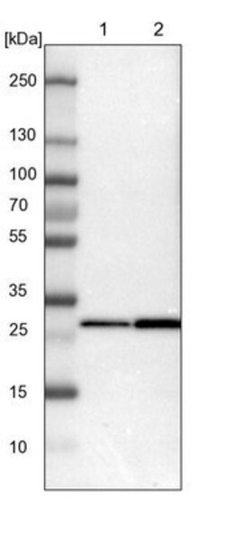 14-3-3 beta/alpha Antibody, Novus Biologicals 0.1mL; Unlabeled:Antibodies,