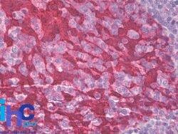 14-3-3 sigma/Stratifin Antibody, Novus Biologicals:Antibodies:Primary Antibodies