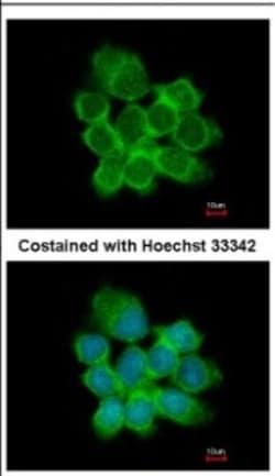 15-PGDH/HPGD Antibody, Novus Biologicals 0.1mL; Unlabeled:Antibodies, Polyclonal