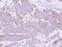 15-PGDH/HPGD Antibody, Novus Biologicals 0.1mL; Unlabeled:Antibodies, Polyclonal