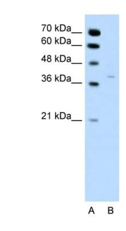 17 beta-HSD1/HSD17B1 Antibody, Novus Biologicals 100&mu;L; Unlabeled:Antibodies,