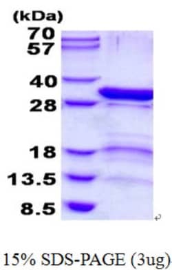 Novus Biologicals&trade;&nbsp;Recombinant Human 26S proteasome subunit 9 His Protein