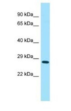 4930567H17Rik Antibody, Novus Biologicals 100&mu;L; Unlabeled:Antibodies,