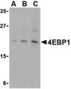 4EBP1 Antibody - BSA Free, Novus Biologicals 0.1mg; Unlabeled:Antibodies,