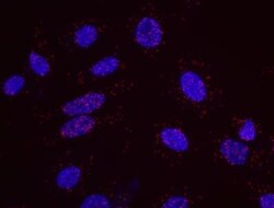 53BP1, p Ser25 Antibody, Novus Biologicals 0.1 mL | Buy Online | Novus Biologicals | Fisher Scientific