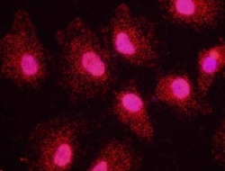 53BP1, p Ser25 Antibody, Novus Biologicals 0.1 mL | Buy Online | Novus Biologicals | Fisher Scientific