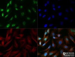 53BP1 Antibody - BSA Free, Novus Biologicals 0.025mL; Unlabeled:Antibodies,