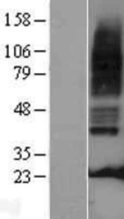Novus Biologicals™ 5-HT3A Overexpression Lysate