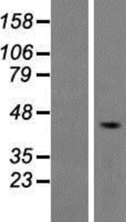 Novus Biologicals&trade;&nbsp;5-HT4 Overexpression Lysate