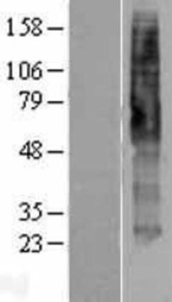 Novus Biologicals&trade;&nbsp;5-HT4 Overexpression Lysate