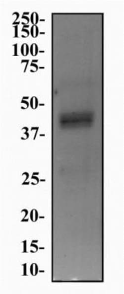 5-HT4 Antibody - BSA Free, Novus Biologicals 0.1mL; Unlabeled:Antibodies,