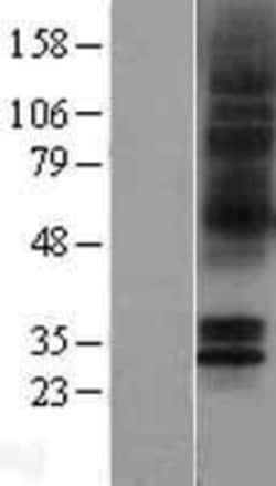 Novus Biologicals&trade;&nbsp;5-HT5A Overexpression Lysate