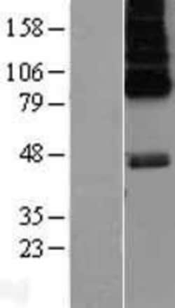 Novus Biologicals&trade;&nbsp;5-HT6 Overexpression Lysate