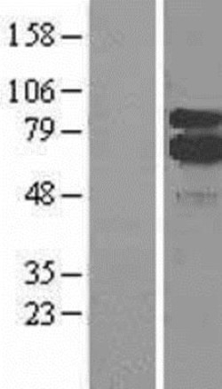 Novus Biologicals&trade;&nbsp;5-Lipoxygenase Overexpression Lysate