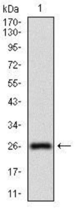 5'-Nucleotidase/CD73 Antibody (4G6E3) - BSA Free, Novus Biologicals 0.1 mL | Buy Online | Novus Biologicals | Fisher Scientific