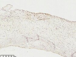 5'-Nucleotidase/CD73 Antibody, Novus Biologicals:Antibodies:Primary Antibodies