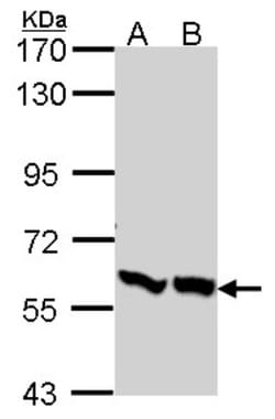 6 Phosphofructo 2 Kinase Antibody, Novus Biologicals 0.1mL; Unlabeled:Antibodies,
