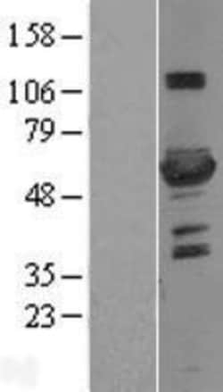 Novus Biologicals&trade;&nbsp;6 Phosphofructo 2 Kinase Overexpression Lysate
