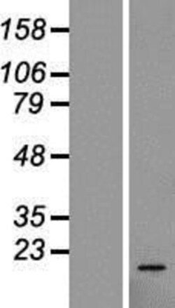 Novus Biologicals™ 60S ribosomal protein L23 Overexpression Lysate