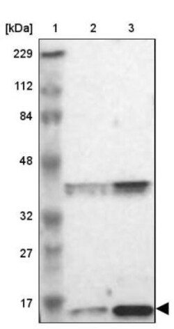 60S ribosomal protein L23 Antibody, Novus Biologicals 0.1mL; Unlabeled:Antibodies,