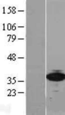 Novus Biologicals&trade;&nbsp;RPSA Overexpression Lysate
