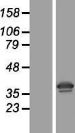 Novus Biologicals&trade;&nbsp;RPSA Overexpression Lysate