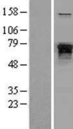 Novus Biologicals&trade;&nbsp;NF-L Overexpression Lysate