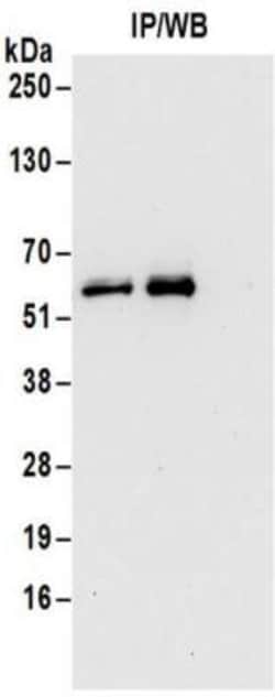 6 Phosphofructo 2 Kinase Antibody, Novus Biologicals 0.1mg; Unlabeled:Antibodies,