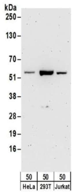 6 Phosphofructo 2 Kinase Antibody, Novus Biologicals 0.1mg; Unlabeled:Antibodies,
