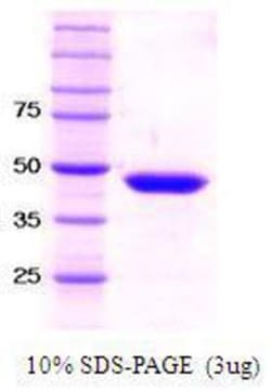 Novus Biologicals&trade;&nbsp;Recombinant Human SETD7/9 Protein