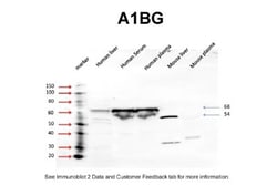 alpha 1B-Glycoprotein Antibody, Novus Biologicals 100 ul; Unconjugated:Antibodies,
